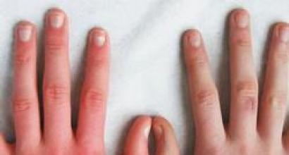 나는 여섯 번째 손가락에 대한 꿈을 꾸었습니다.  꿈의 해석 손가락.  슬라브 꿈의 책에 따른 손가락
